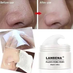 چسب بینی لانبنا بانوشاپ